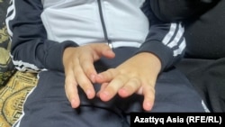 Хотамджон с детства страдает детским церебральным параличом и аутизмом