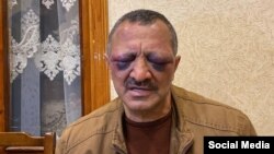 Оппозициялық саясаткер Тофик Ягублу. 