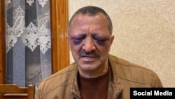 Tofiq Yaqublu, 60, said police beat him while demanding that he say on camera that he would stop criticizing Azerbaijan's leadership.