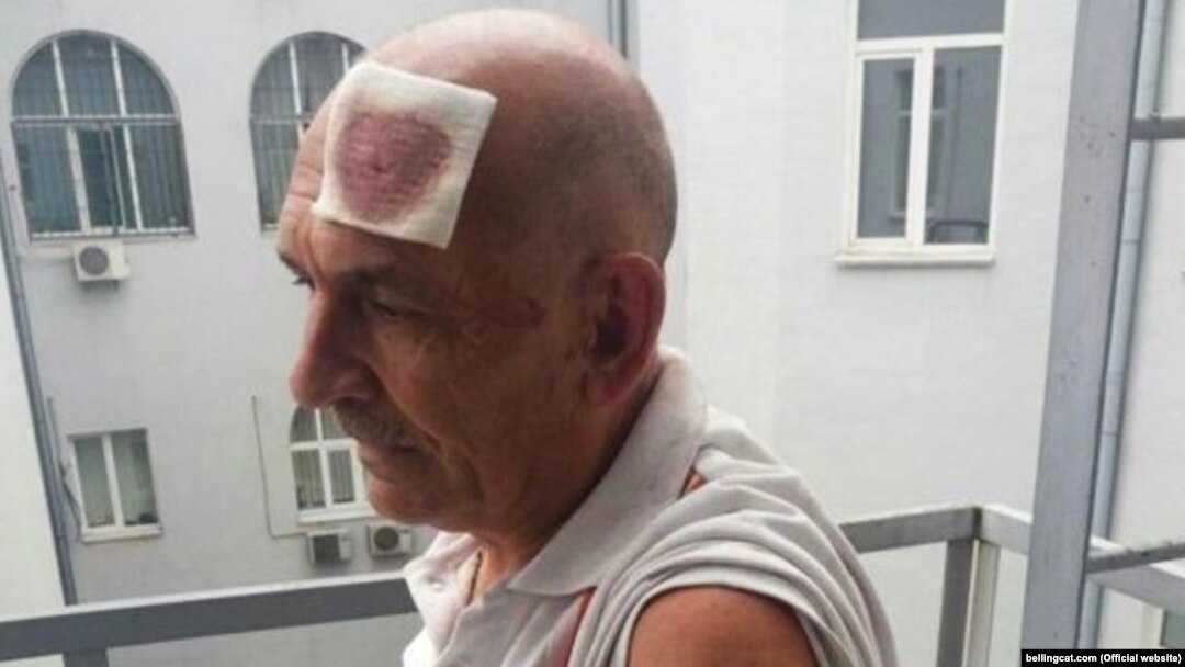 An undated photo of Tsemakh reportedly taken after his arrest.