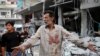 A Syrian man with a blood stained shirt gestures near debris following a reported Russian air strike in the district of Jisr al-Shughur, in the Idlib province, September 25, 2017