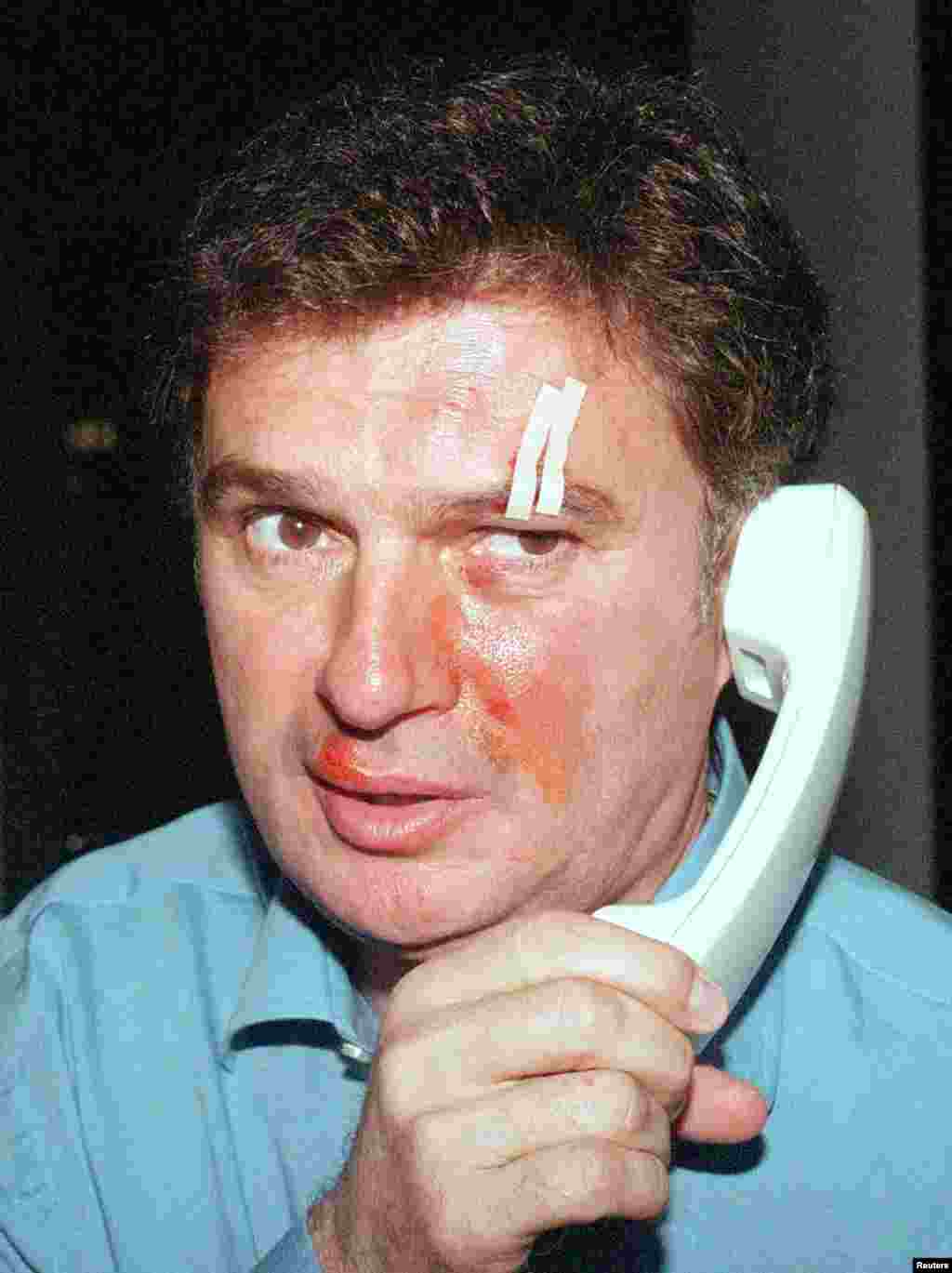 Partizan coach Ljubisa Tumbakovic is seen after clashes broke out during an October 2000 football match with Red Star.While the rivalry today has little overt political or ethnic dimensions, their matches are known for creating some of the most intense stadium experiences in football, led by large contingents of hardcore fans, or “ultras.”