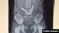 Баланын ичиндеги магнит.