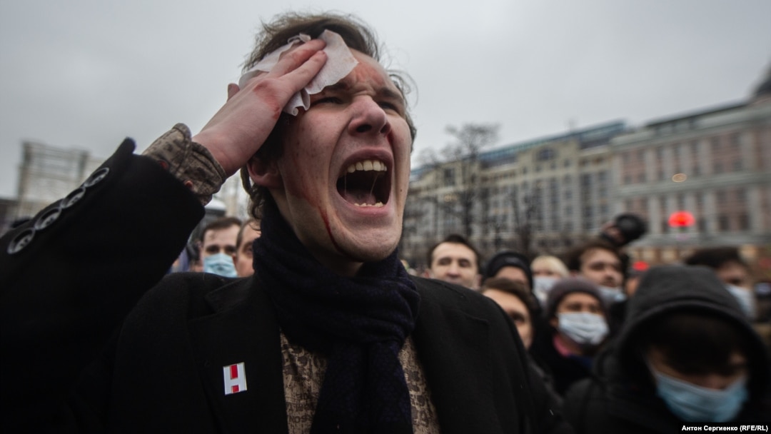An injured protester expresses his rage at riot police in Moscow on January 23.