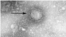 2019-nCov coronavirus