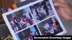 Алмаз Акчекеевдин жараат алгандан кийинки сүрөттөрү.