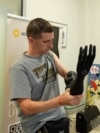 Din cauza războiului, ucrainenii au nevoie de membre artificiale. Companii noi încep să le livreze