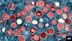 ამერიკის ალერგიისა და ინფექციური დაავადებების ეროვნული ინსტიტუტის NIAID მიერ გავრცელებულ სურათზე ჩანს მაიმუნის ყვავილის ნაწილაკები (წითელი) ინფიცირებულ უჯრედში (ლურჯი)