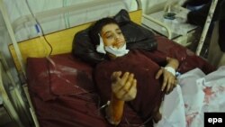 An injured young victim of the bomb blast at a hospital in Peshawar on January 23