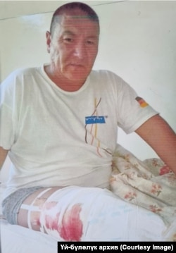 Бакыт Тургунбаев операциядан кийин. 2010-жыл.