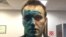 Aleksei Navalny after being attacked with green dye on April 27