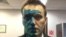 Russian opposition leader Aleksei Navalny says his eyesight might be impaired after his face was splashed with a green "zelyonka" antiseptic. (file photo)