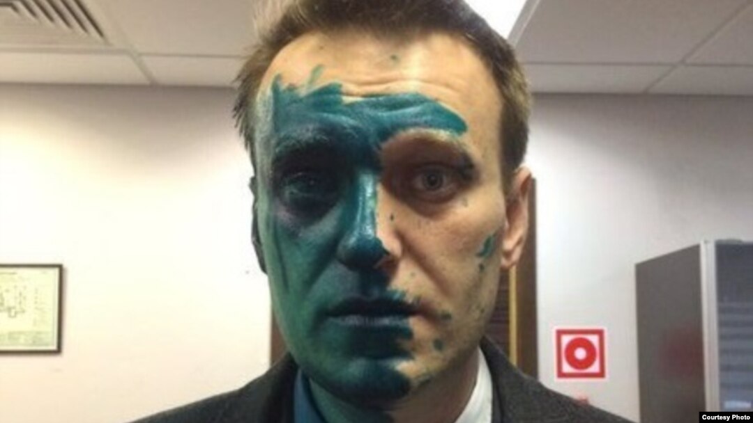 Aleksei Navalny said that his vision in the eye was still considerably impaired after surgery and that it could take several months for it to be restored.