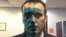 Алексей Навальный после нападения 