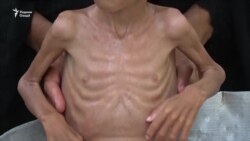 Кӯдакони гуруснаро кӣ наҷот медиҳад?