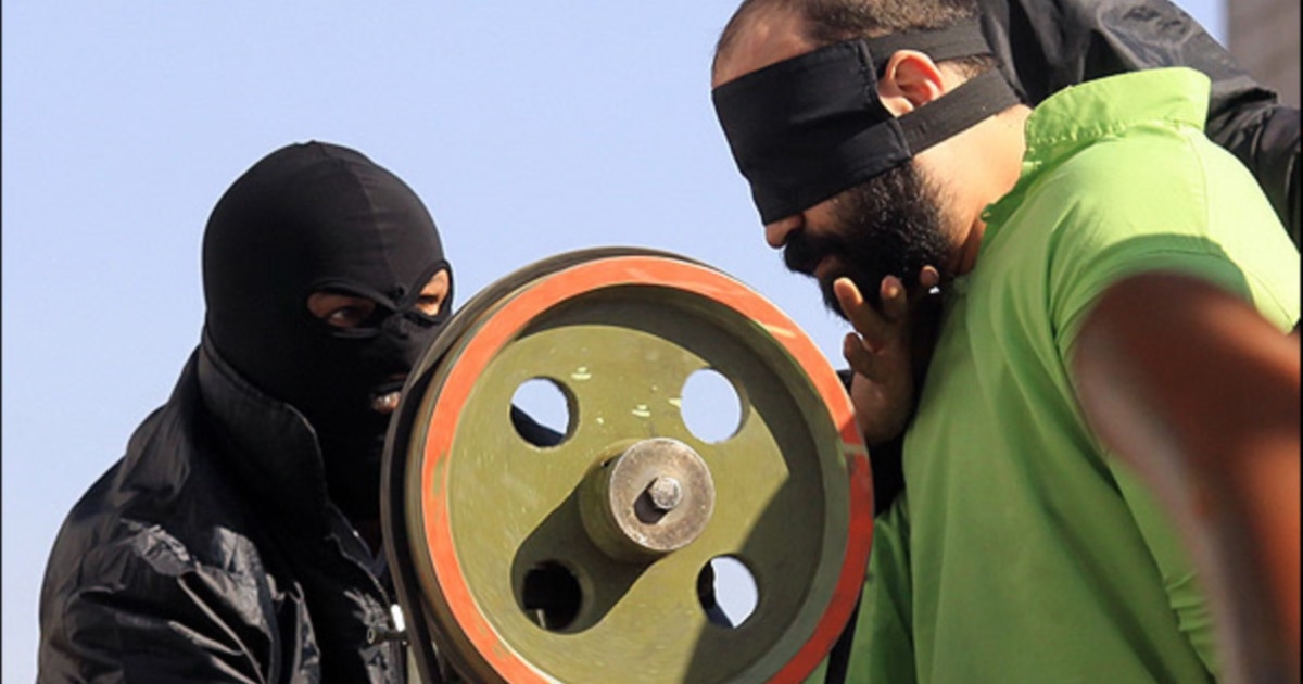 Iran Urged To Abolish Abhorrent Amputations After Thief Has Hand Cut Off