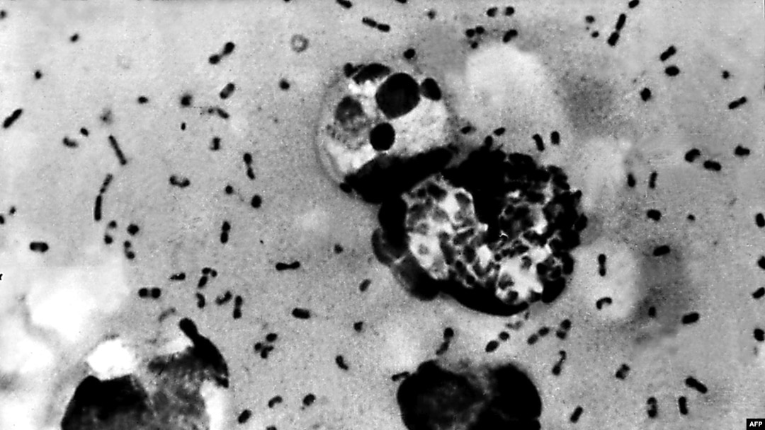 Bacteria care provoacă ciumă bubonică