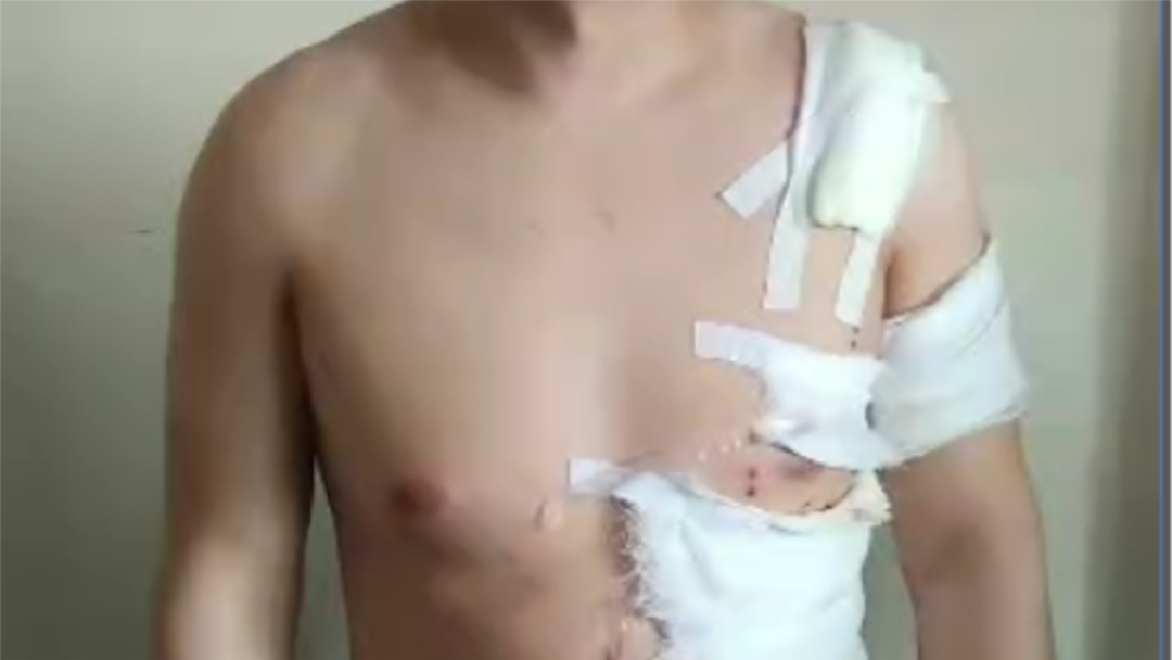 Jinsiy pozalar fotosuratlari