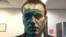Алексей Навальный после нападения 