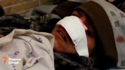 В Афганистане муж отрезал нос своей жене