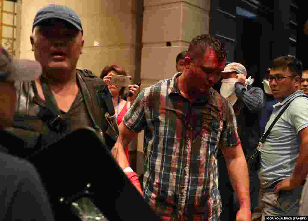 A blood-soaked man at the entrance to a building inside Atambaev&rsquo;s residence.