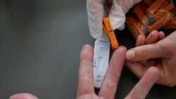 Testiranje na korona virus, Francuska