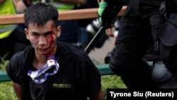 პოლიციის რეიდის დროს ნაცემი სტუდენტი 