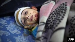 A wounded Syrian boy looks on at a makeshift hospital following reported Syrian government air strikes on the rebel-held town of Arbin on the outskirts of the capital, Damascus, on May 9.