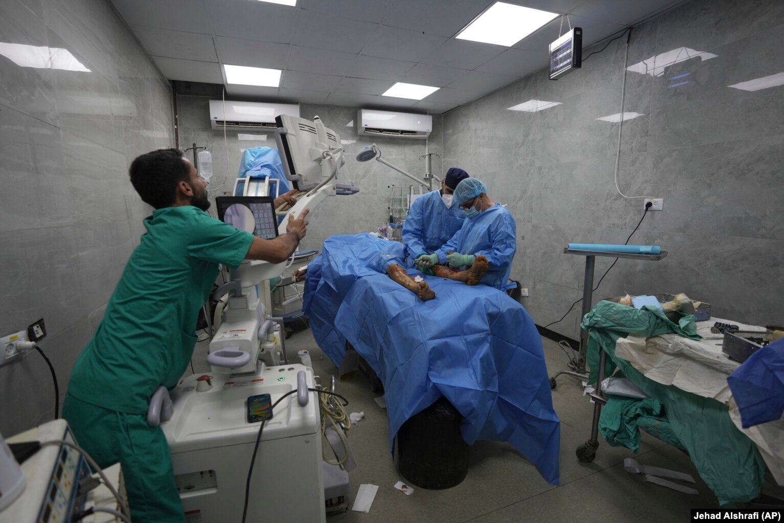 Dr. Ashraf al-Bayya dhe ekipi i tij duke operuar një pacient me lëndim të këmbës, të shkaktuar nga një sulm izraelit, në një sallë kirurgjike në spitalin Shifa.