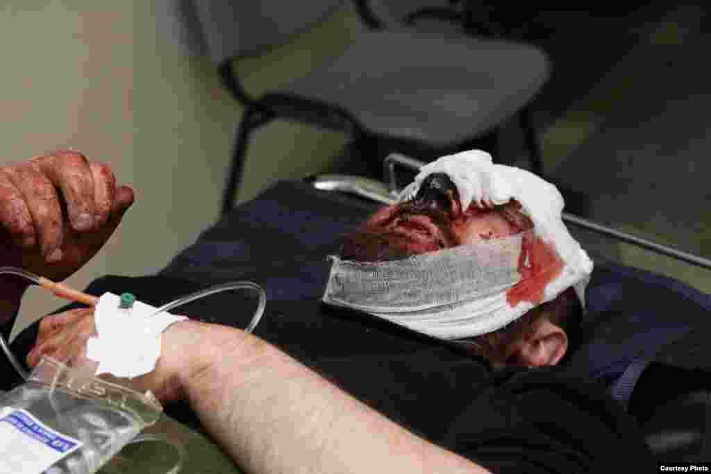 Armenija - Pretučen novinar - Urednik agencije ¨Armenija danas¨, Argishti Kiviryan, teško je pretučen u Yerevanu. 