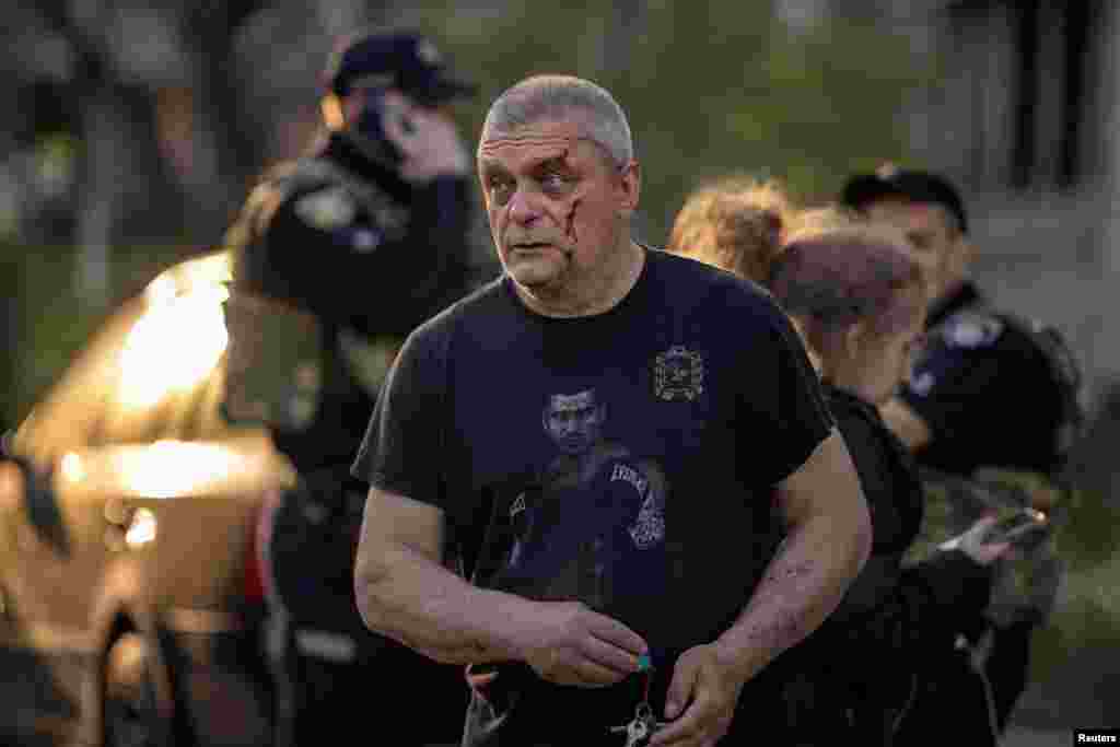 An injured man walks at the site of a Russian missile attack on a residential area in Kharkiv, Ukraine, on April 18