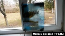 Рентгеновский снимок.