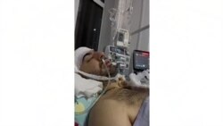 Президент айтган адолат ҳаётда йўқ. Ўзбек жамиятидаги агрессиянинг илдизи қаерда?