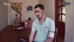 Ëнғиндан танасининг 60 фоизи куйган Отабек ҳукуматдан ëрдам сўрамоқда