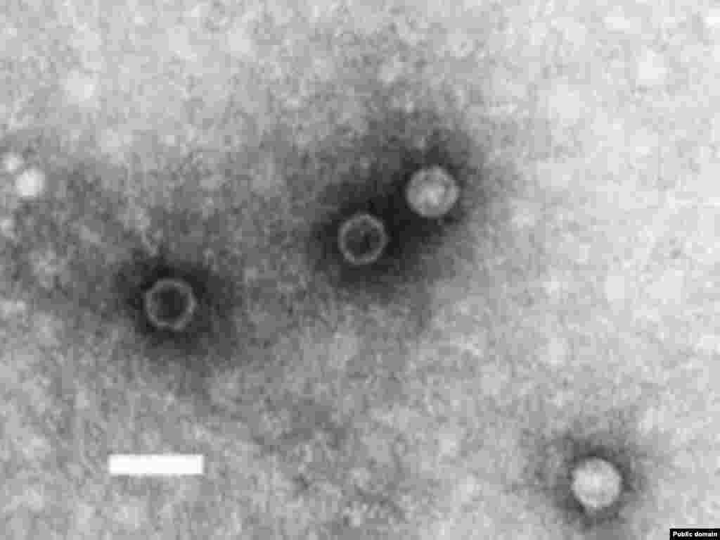 USA -- Note that poliovirus particles exhibit a basically featureless appearance in comparison to other small viruses such as astrovirus, Norwalk virus and other SRSVs, and typical (non-SRSV) calicivirus. Bar = 50 nanometers. - Description: Note that poliovirus particles exhibit a basically featureless appearance in comparison to other small viruses such as astrovirus, Norwalk virus and other SRSVs, and typical (non-SRSV) calicivirus. Bar = 50 nanometers. Method: Negative-stain Transmission Electron Microscopy on cell culture.