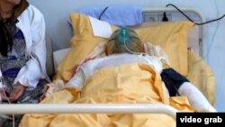 Инвалид Карабахской войны Заур Гасанов в больнице после акта самосожжения, совершенного 25 декабря 2013 Архивное фото.