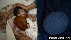 یک کودک مصاب به سوء تغذیه