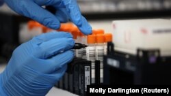 Një punëtor shëndetësor analizon disa mostra që dyshohet se janë me koronavirus. Britani, 2 qershor 2021.
