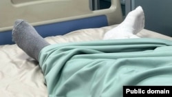 Կոտրվածքներ ստացած Սոնա Բաղդասարյանի դուստրը