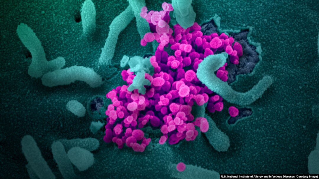 Imagine surprinsă la microscop electronic cu SARS-Cov2