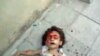 The Death Of Oula Jablawi And The Democratization Of Bearing Witness