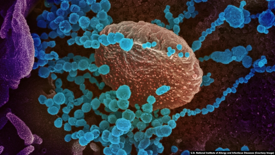 Sars-Cov 2, în albastru, după ce a infestat un țesut, surprins de microscopul electronic