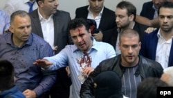 Zoran Zaev (center) was injured in the 2017 invasion of the parliament in Skopje.
