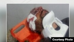 عکسی که از بصیر احمدزاده، کولبر پاوهای پس از زخمی شدن منتشر شده است