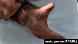 Եսայի Քարամյանի ձեռքը