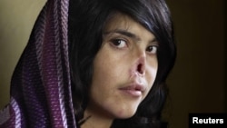 Aisha, who appeared on the cover of "Time" magazine in 2010, was not the last Afghan woman to be so disfigured. 