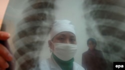 Nine million new cases of tuberculosis are reported each year