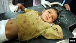 A young boy who was injured in the suicide bomb blast in Peshawar on February 10 receives medical treatment at a local hospital.