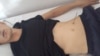 A picture has circulated on social media showing a man identified as Uzynzhasov with what appears to be his abdomen punctured with a metal stick.