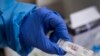 Pozitív koronavírus-tesztet tart a kezében az Országos Mentőszolgálat munkatársa a mentőszolgálat óbudai szűrőbuszában 2020. november 13-án.